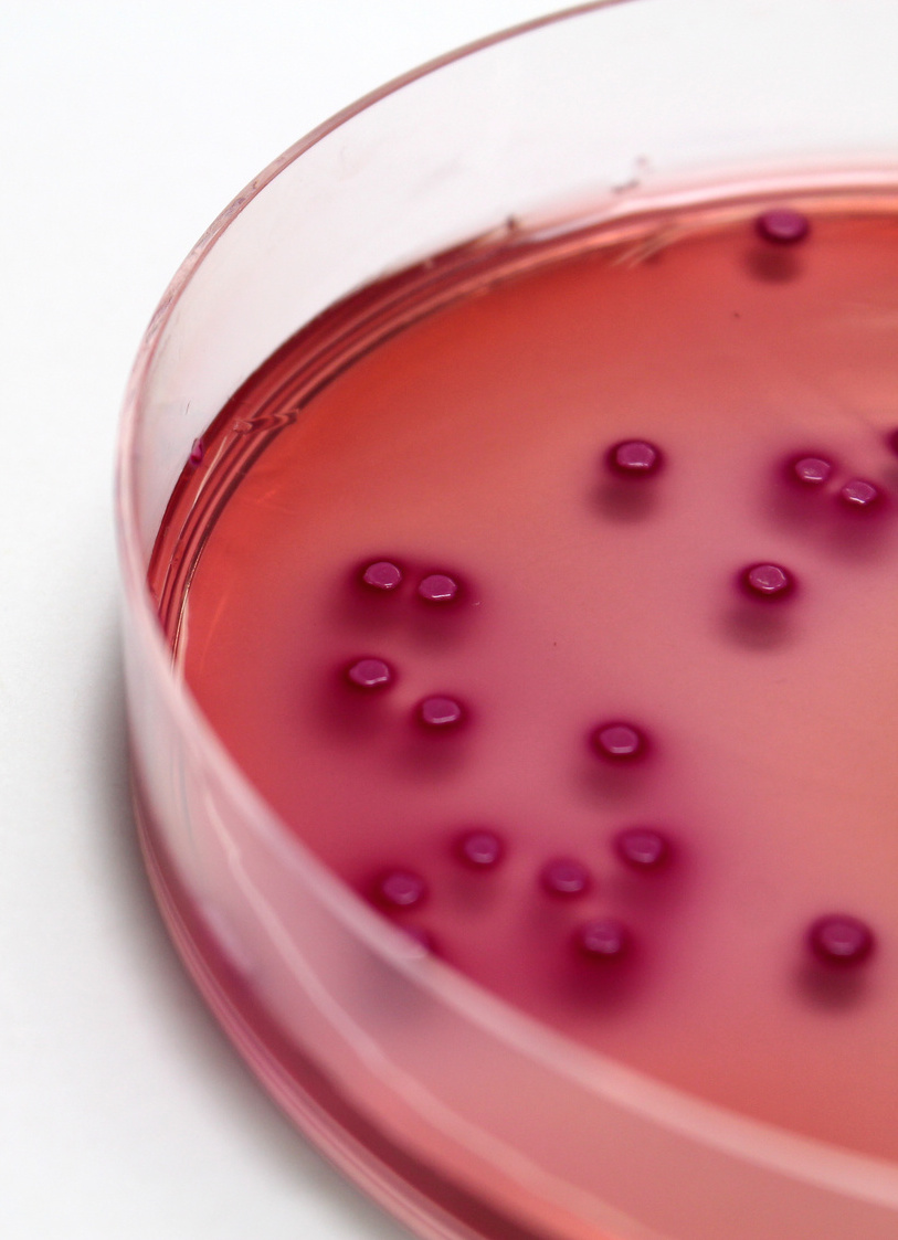 What to do about Strep Throat